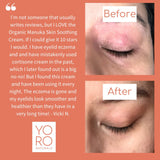 Yoro Manuka Honey Soothing Cream Original | Eczema + Irritated Skin - Radiant Beauty